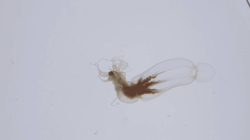 anemone-mer-cancer-pediatrique-csm